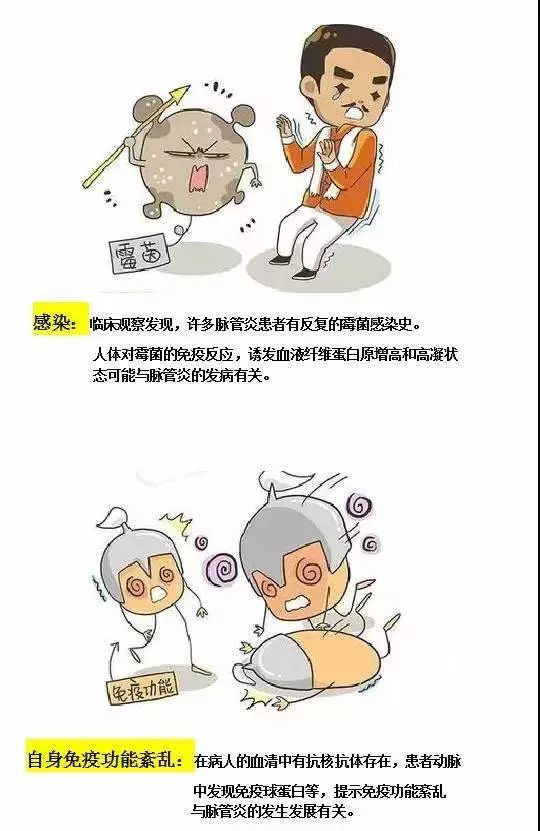 脉管炎危害这么大，你却不知道……